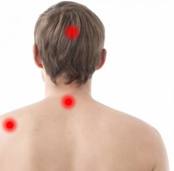 Foci of osteoarthritis