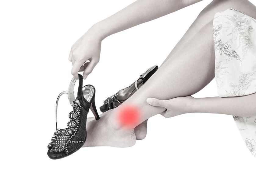 Ankle joint pain due to arthritis