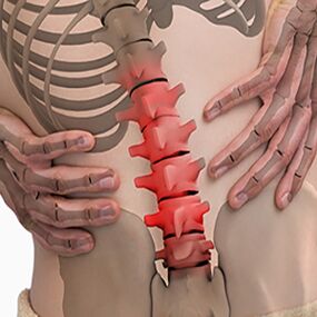 Lumbar spinal cord tumors