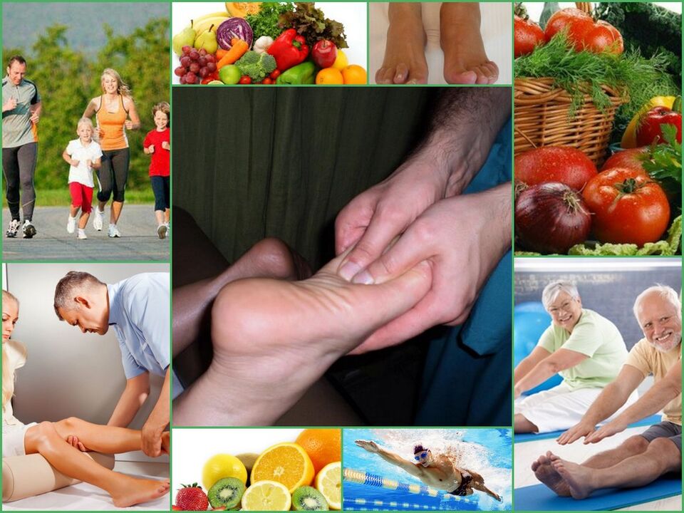 Arthrosis of knee prevention